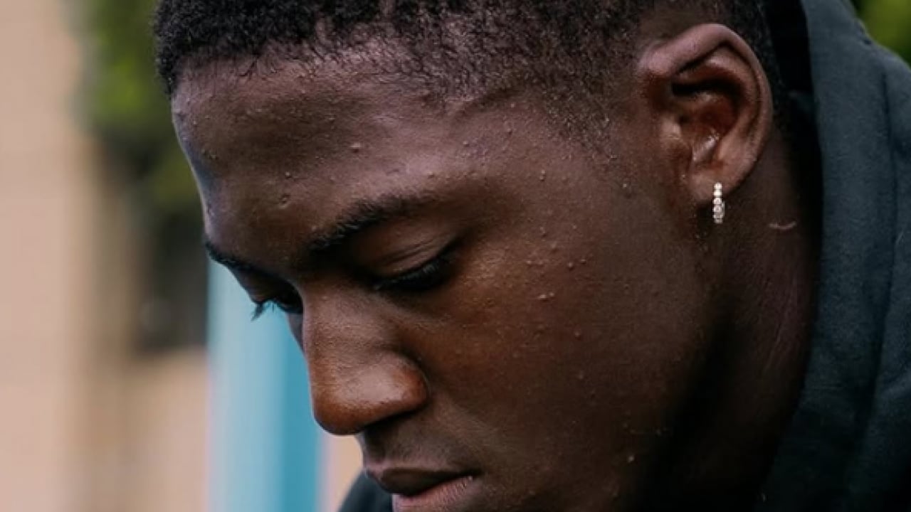 Foto - Beşiktaş İngiliz yıldız için devreye girdi: Her ne kadar işleri zor olsa da hedef belli...