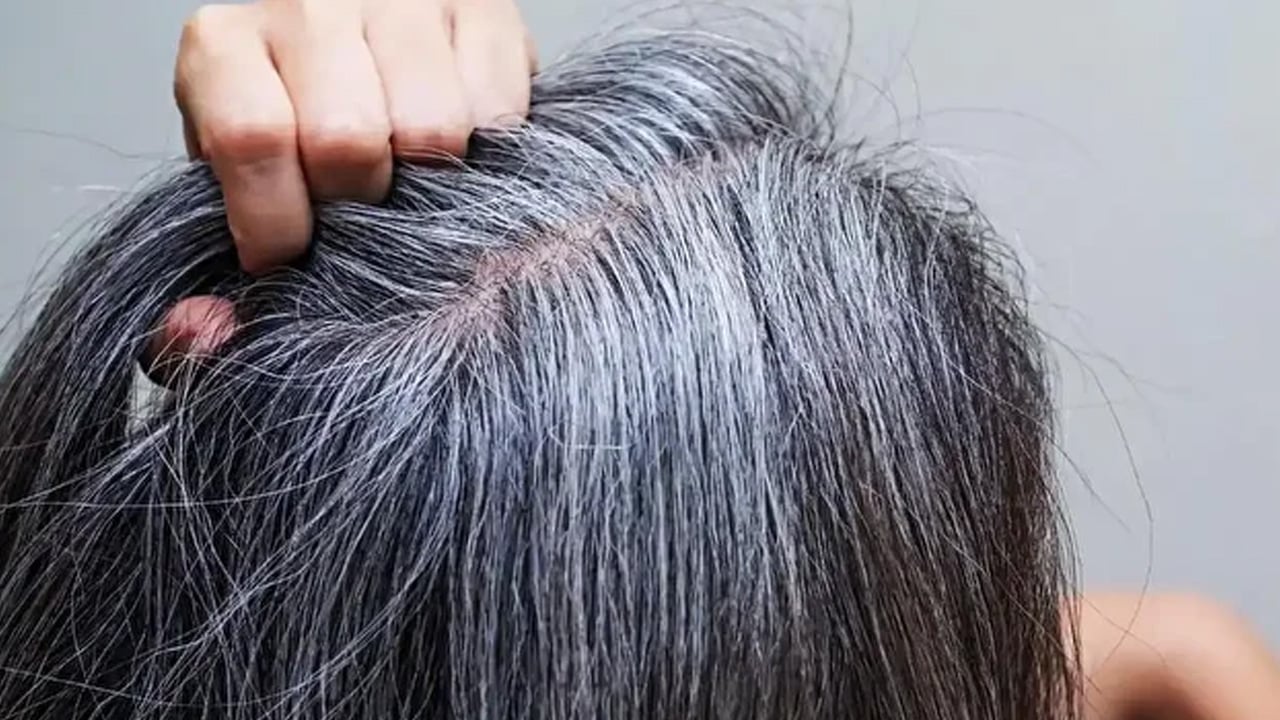 Beyaz saça uygulamaya başladılar: Fazla fazla saç çıkaracak! Rapunzel gibi uzun saçlar çıkıyor!