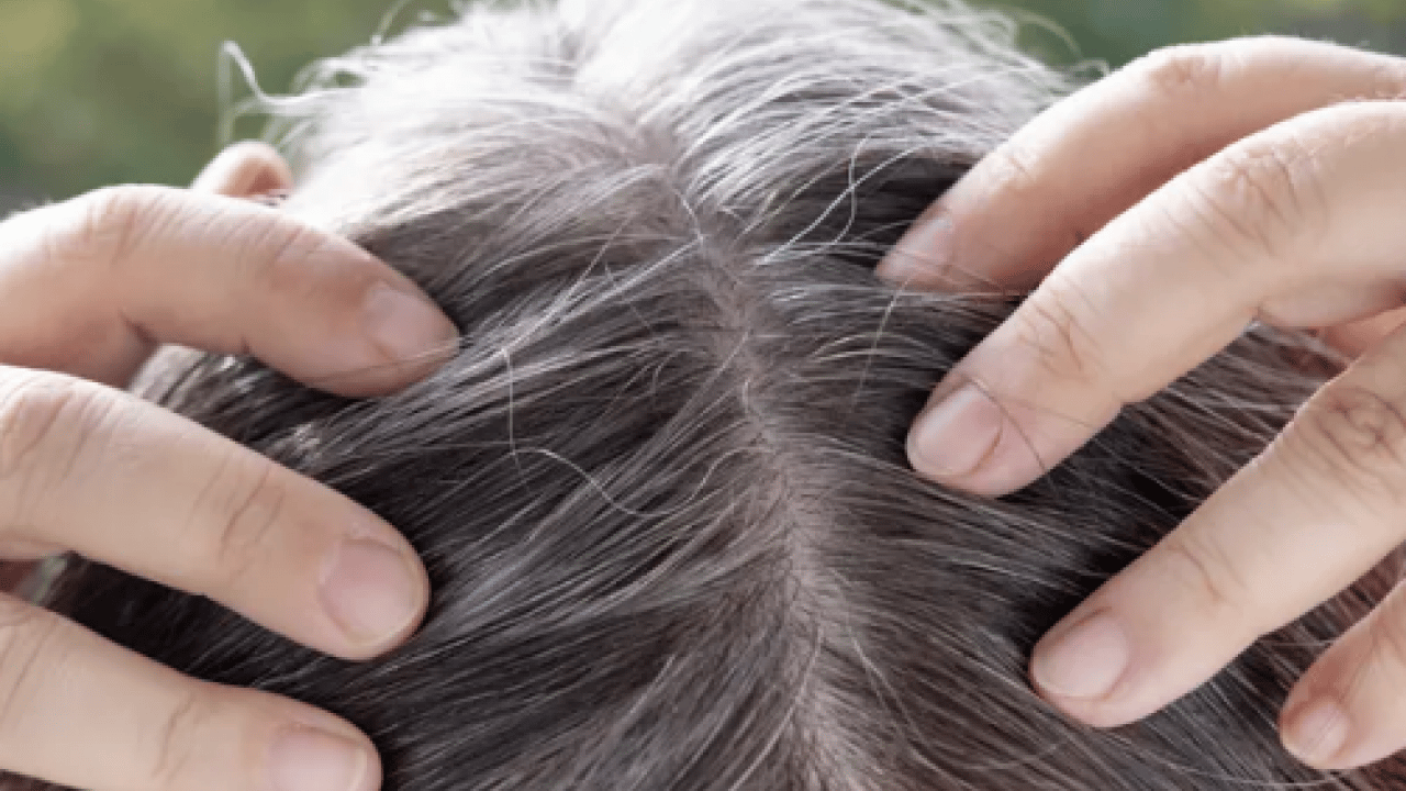 Foto - Beyaz saçlar aslında vücudu koruyor olabilir... Yaşlanmanın işareti sanıyorduk oysa ki!