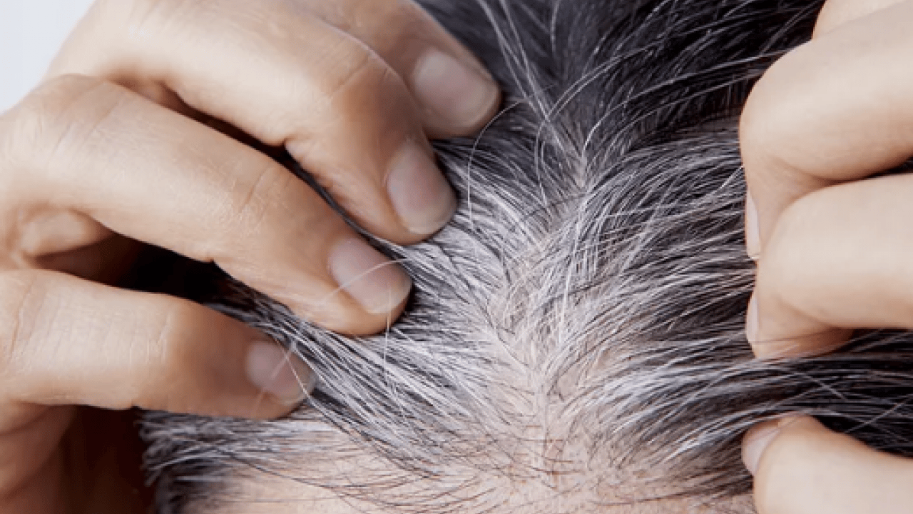 Foto - Beyaz saçlar aslında vücudu koruyor olabilir... Yaşlanmanın işareti sanıyorduk oysa ki!