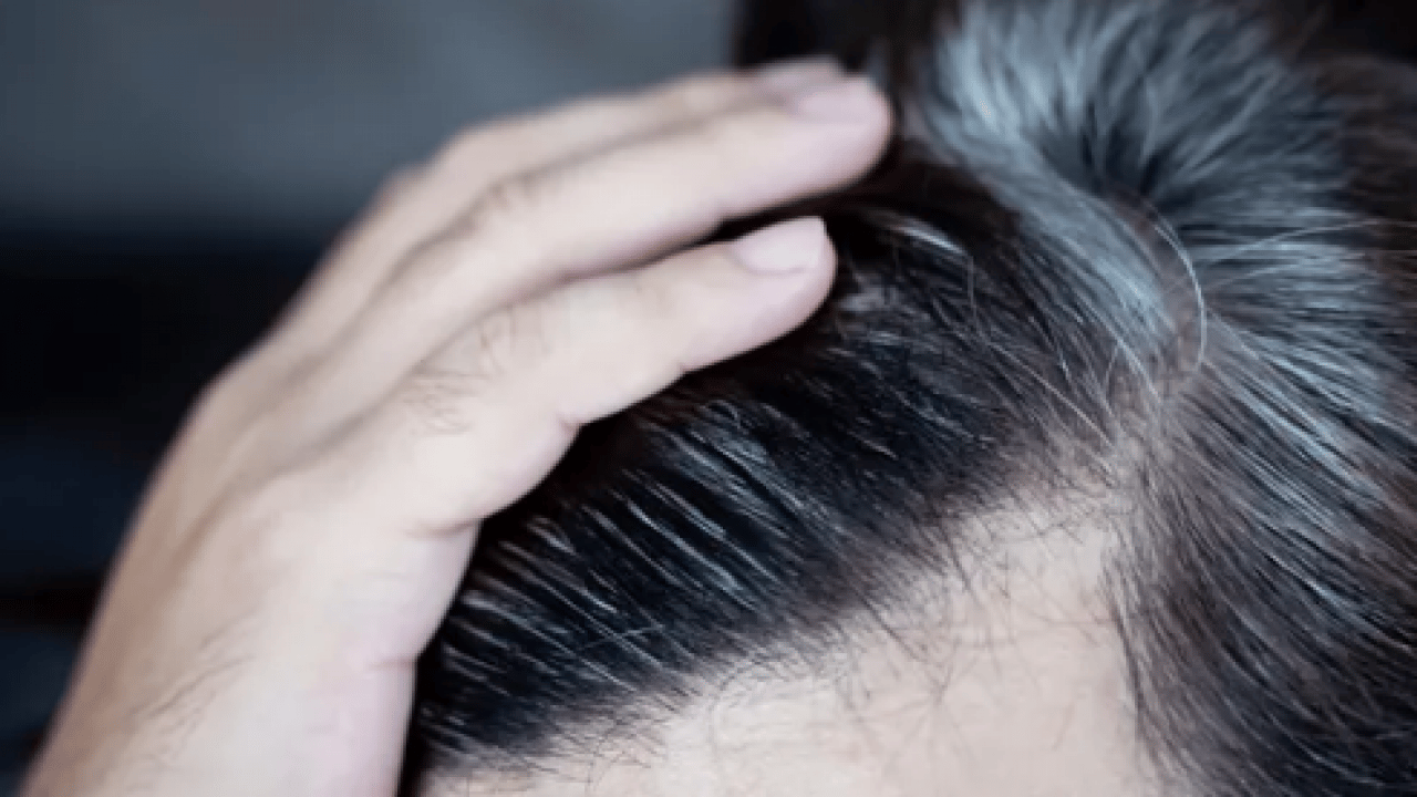 Foto - Beyaz saçlar aslında vücudu koruyor olabilir... Yaşlanmanın işareti sanıyorduk oysa ki!