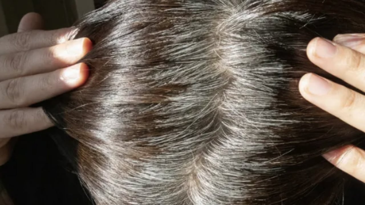 Foto - Beyaz saçlar aslında vücudu koruyor olabilir... Yaşlanmanın işareti sanıyorduk oysa ki!