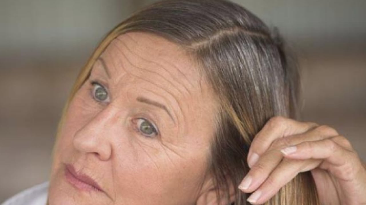 Foto - Beyaz saçları doğal rengine döndürüyor! Boya gibi iki balık: Müthiş şifa olacak