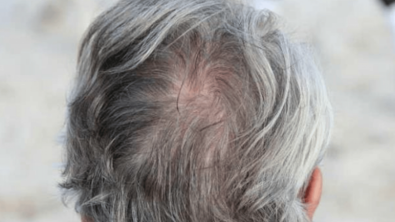 Foto - Beyaz saçları doğal rengine döndürüyor! Boya gibi iki balık: Müthiş şifa olacak