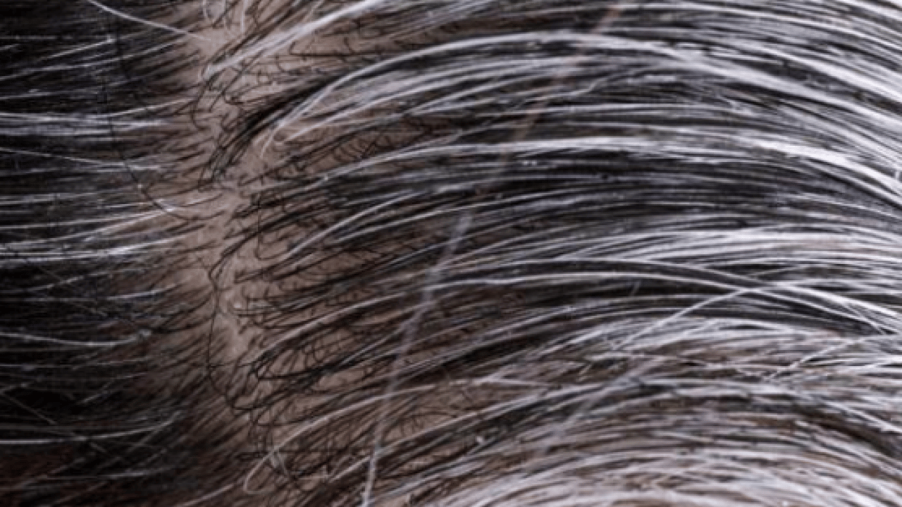 Foto - Beyaz saçları doğal rengine döndürüyor! Boya gibi iki balık: Müthiş şifa olacak