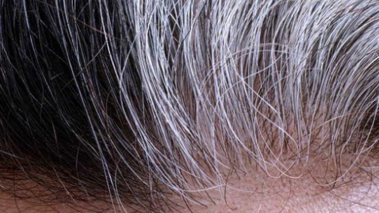 Foto - Beyaz saçları doğal rengine döndürüyor! Boya gibi iki balık: Müthiş şifa olacak