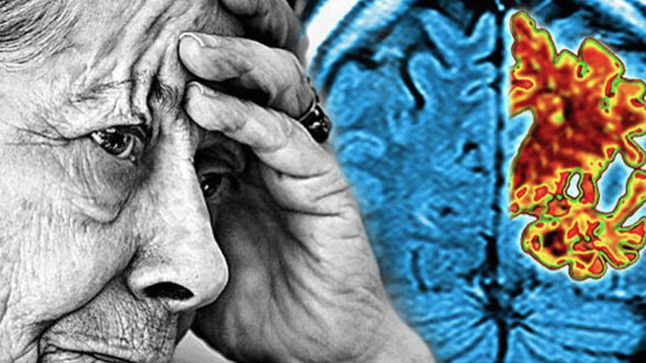 Foto - Beyin sağlığını korumada viral enfeksiyonlar... Alzheimer riskini 31 kat artırıyor! Dikkat Nörologlar açıkladı