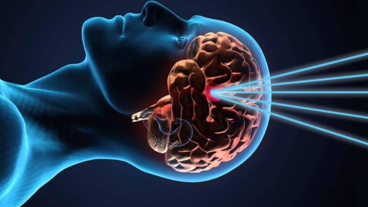 Foto - Beyin silahları zihine hükmediyor