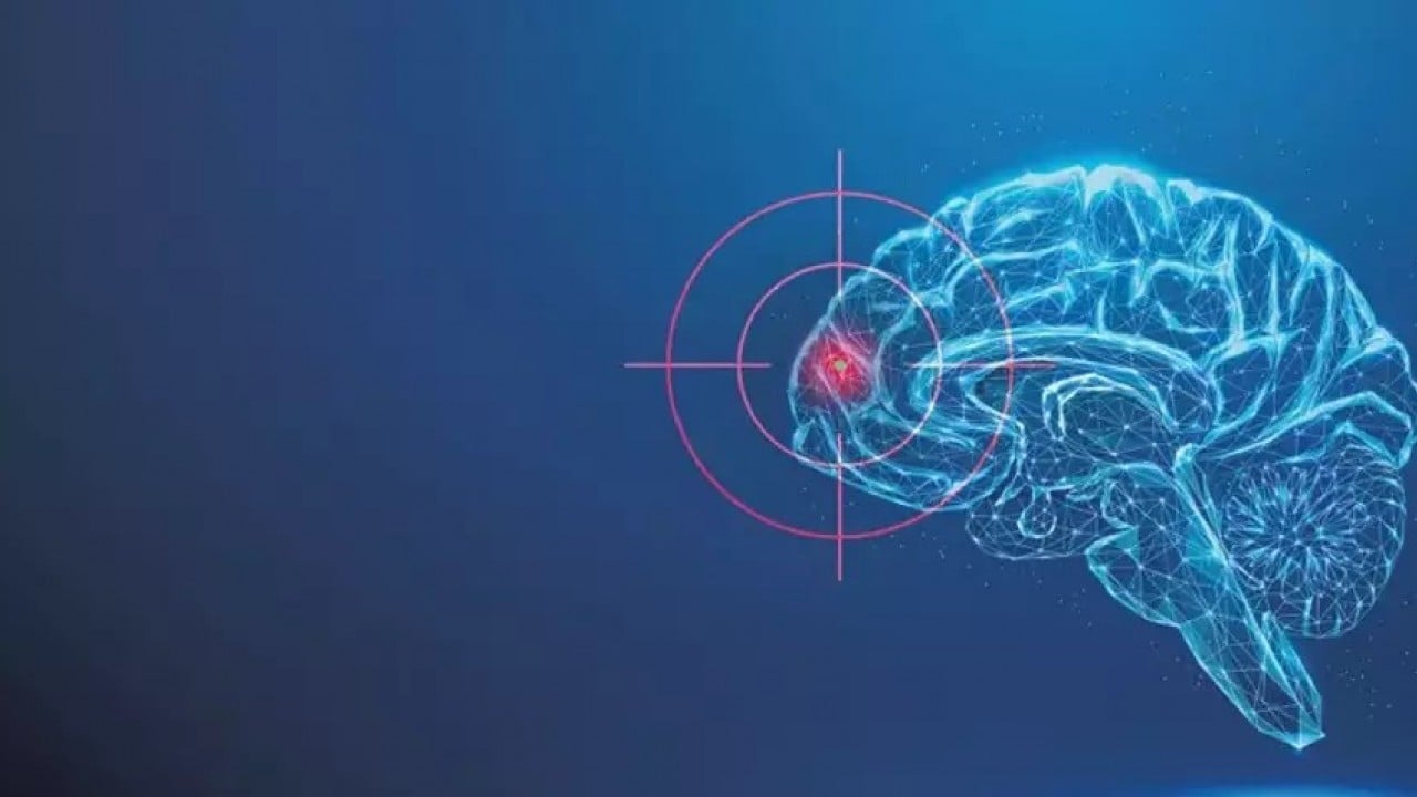 Foto - Beyin silahları zihine hükmediyor