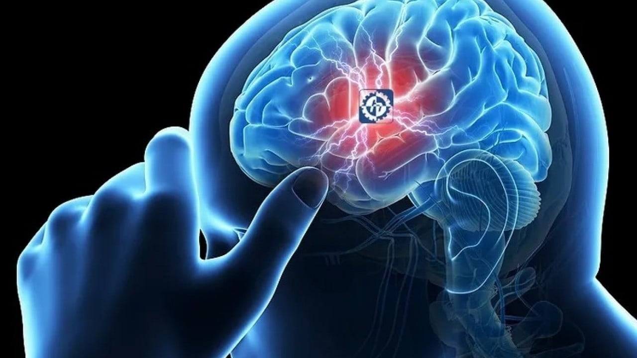 Foto - Beyin silahları zihine hükmediyor