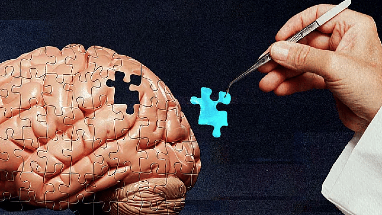 Foto - Beyin sisini saniyeler içinde dağıtıyor! Canan Karatay açıkladı! Beyniniz bulanıyorsa...