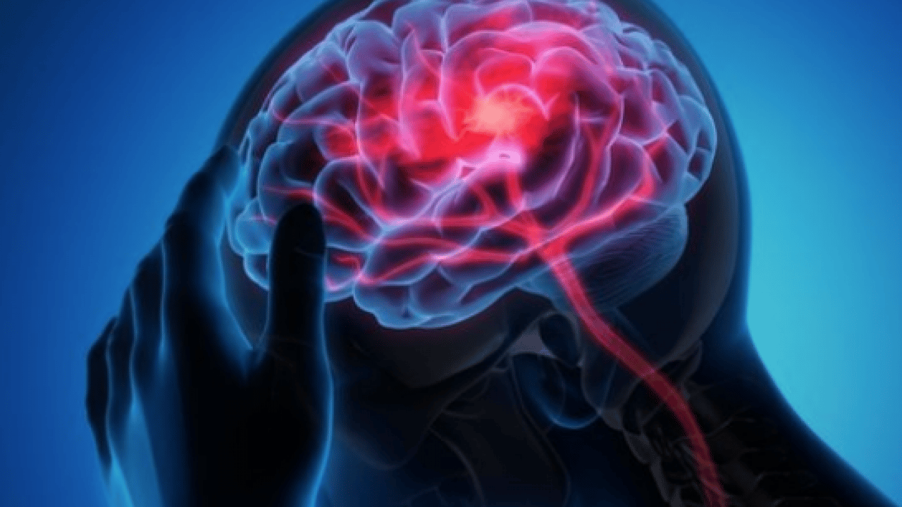 Foto - Beyin sisini saniyeler içinde dağıtıyor! Canan Karatay açıkladı! Beyniniz bulanıyorsa...