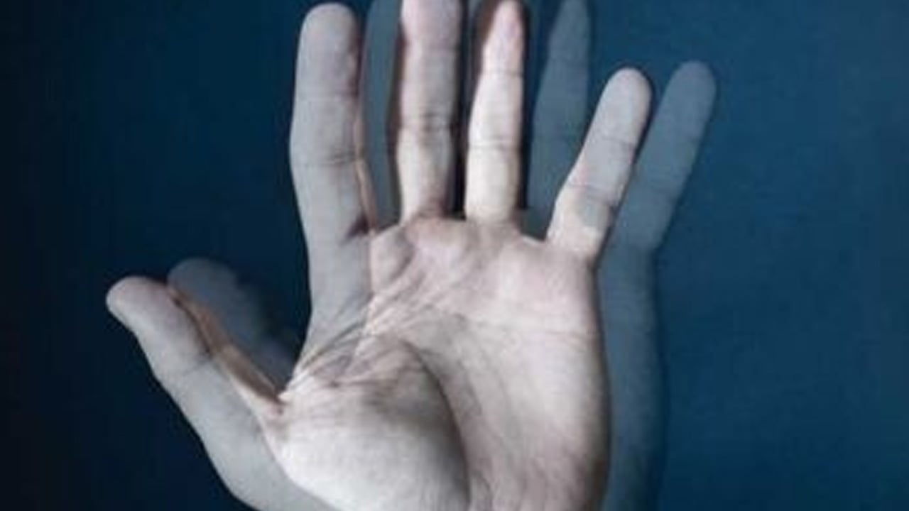 Foto - Beyin ve Sinir Cerrahisi uzmanından uyarı: Baş ağrısının asıl nedeni beyincik sarkması! En büyük sorun bu...