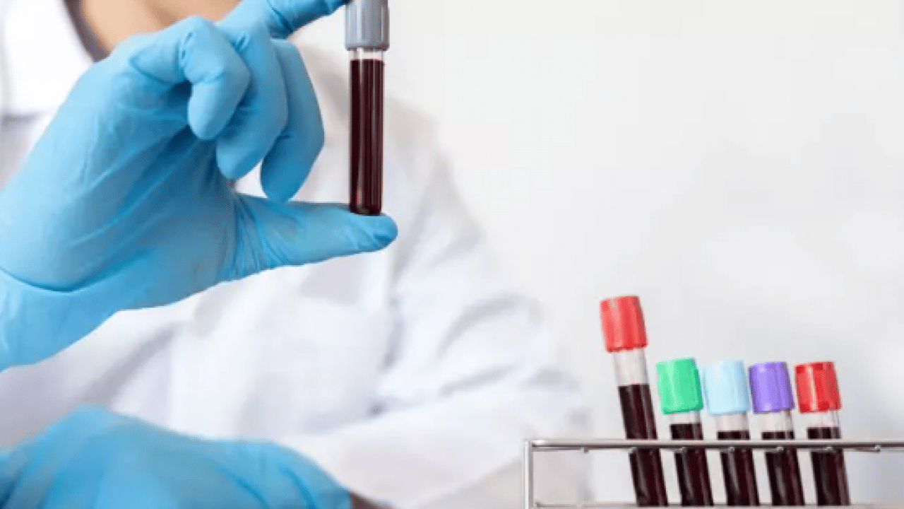 Foto - Bilim adamları açıkladı: Acıya en dayanıklı kan grubu belli oldu! 