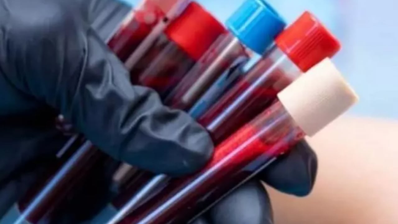 Foto - Bilim adamları açıkladı: Acıya en dayanıklı kan grubu belli oldu! 