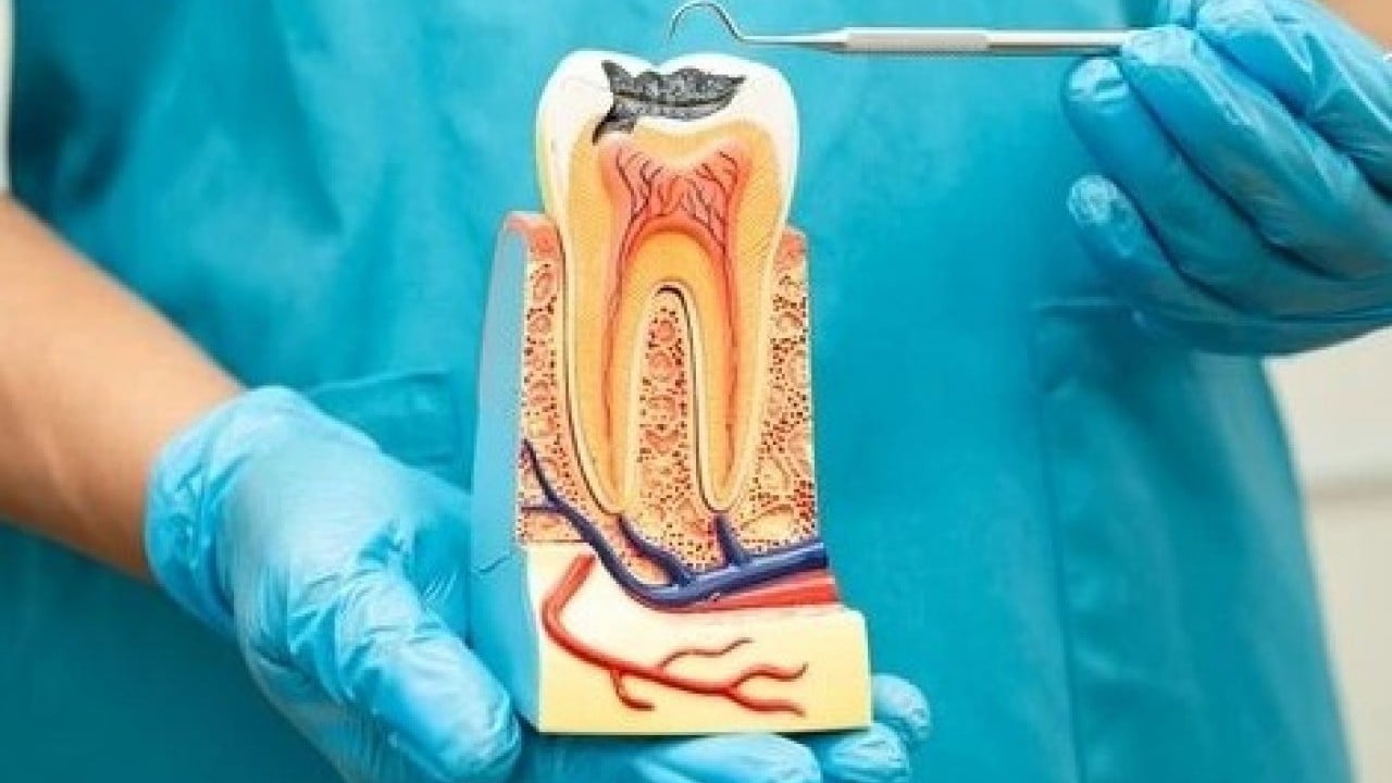 Foto - Bilim adamları açıkladı! Diş tedavisinde tarihe geçecek çalışma