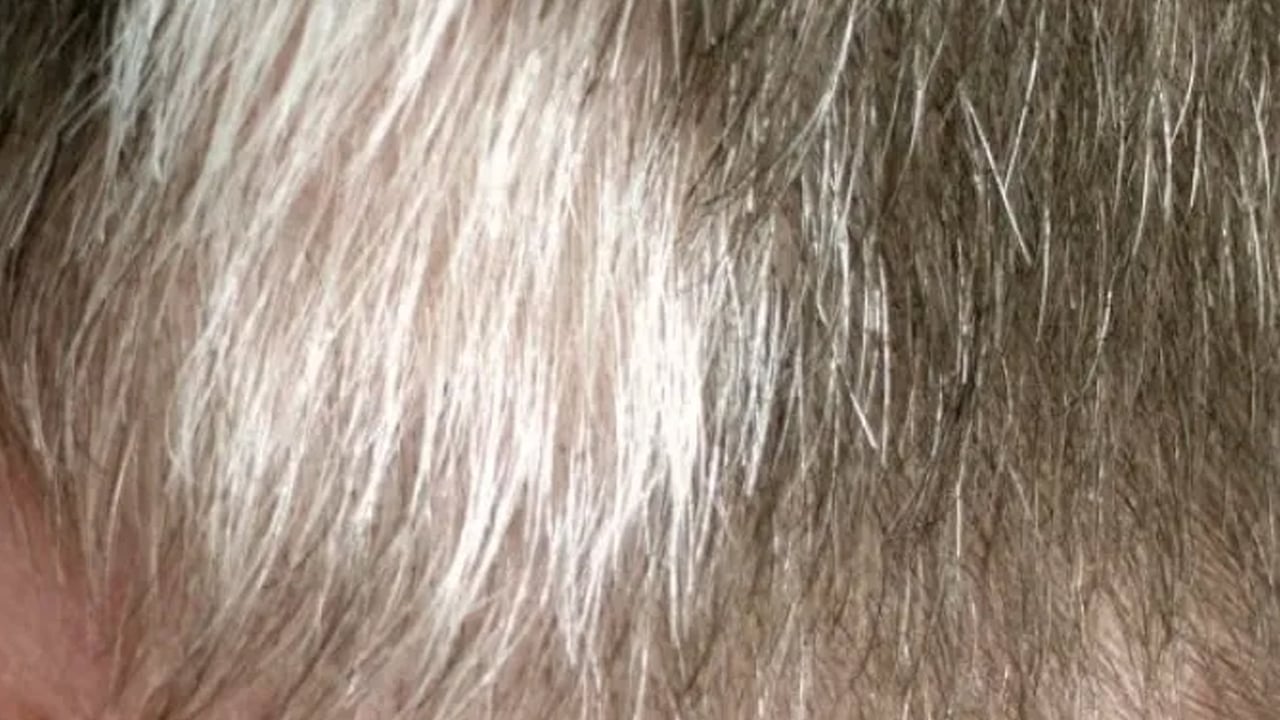 Foto - Uzmanlar cilt sistemi hakkında öyle şeyler açıkladılar ki.... Şok olacaksınız