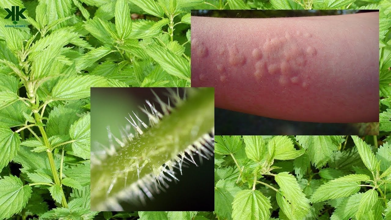 Foto - Bir dokunuşu yakıyor: Doğal demir, kalsiyum, magnezyum içeren ısırgan otu! Demir depoları iki katına çıkacak