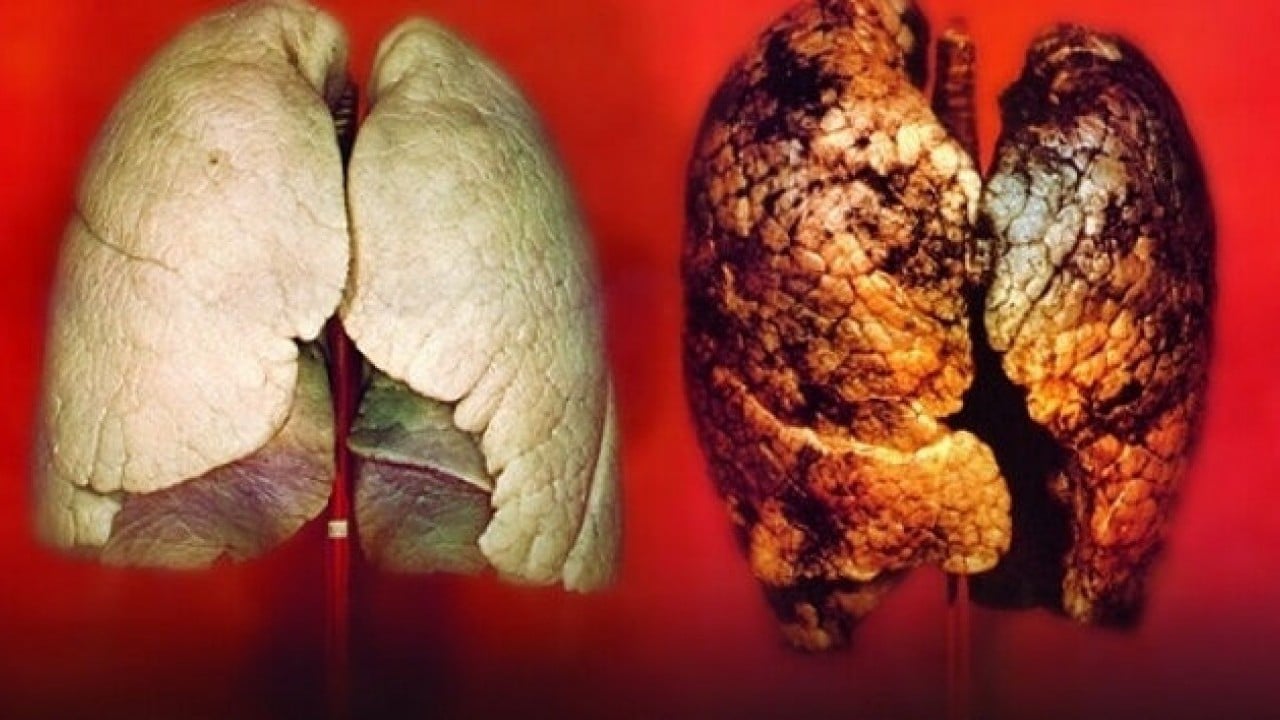 Foto - Bir nefeslik şifa: İç çekmek akciğerleri iyileştiriyor