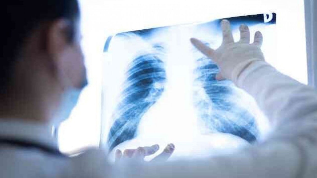 Foto - Bir nefeslik şifa: İç çekmek akciğerleri iyileştiriyor