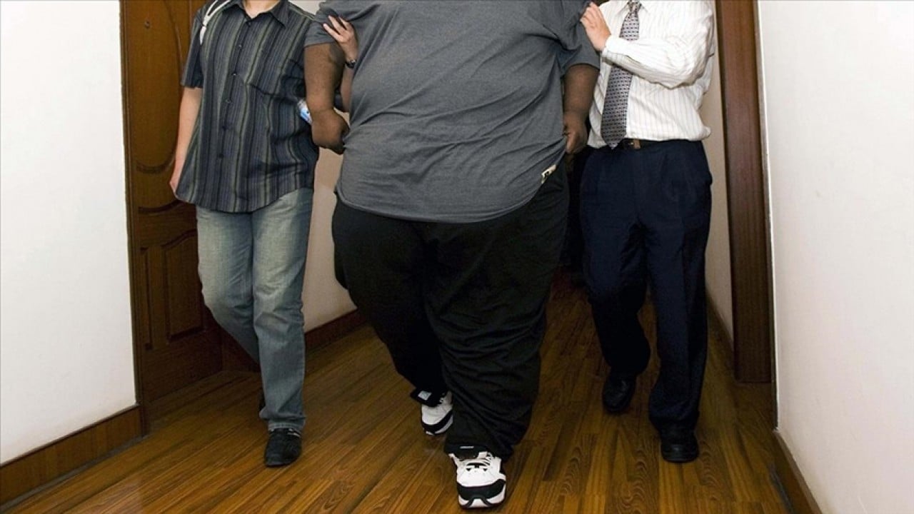 Foto - Bir obezite gerçeği daha! Görme bozukluklarına da neden olabiliyor