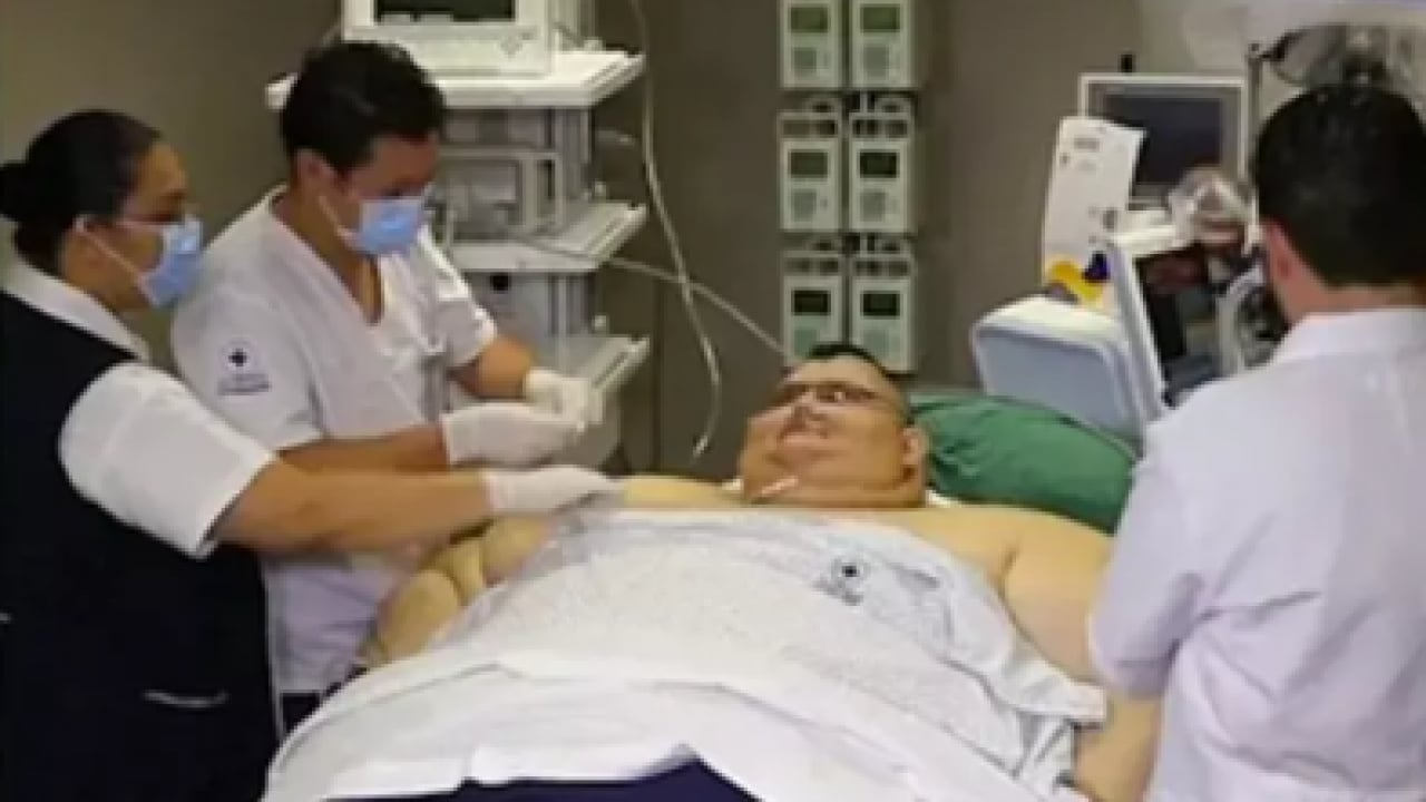 Foto - Bir zamanlar dünya rekortmeniydi: Meksikalı fenomenin hazin sonu!