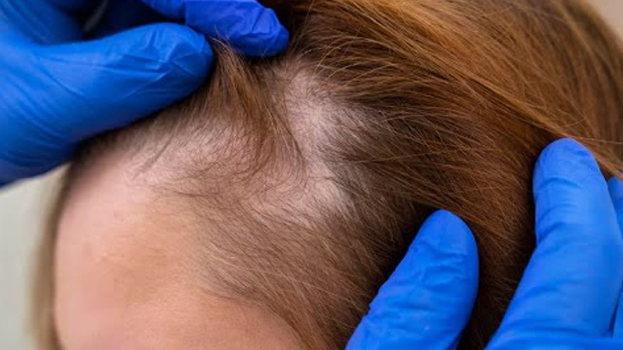 Bıttım sabununun faydaları: Bıttım sabunu ne işe yarar! Uzmanlar saça faydası ne açıkladı! Büyük bir fayda var! 