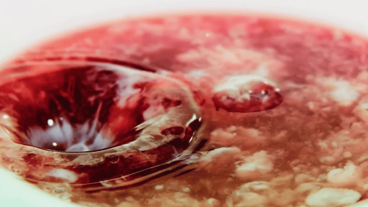 Böbrekleri çökertiyor: Meğer taş yapıyormuş! Sağlıklı diye bardak bardak içiyoruz: