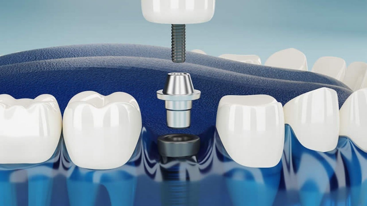 Foto - Bomba teklif Meclis'e geldi! O diş tedavisi ücretsiz oluyor