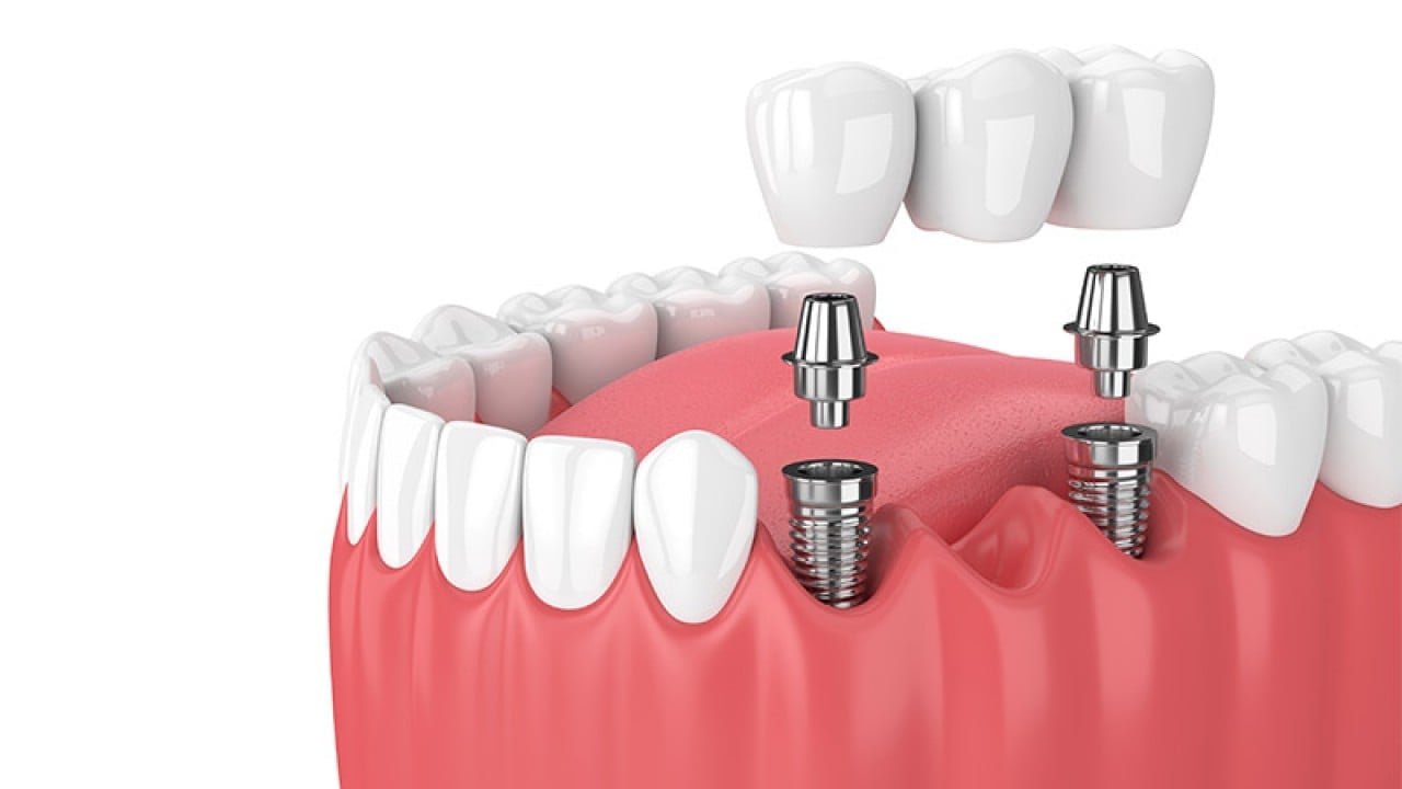 Foto - Bomba teklif Meclis'e geldi! O diş tedavisi ücretsiz oluyor