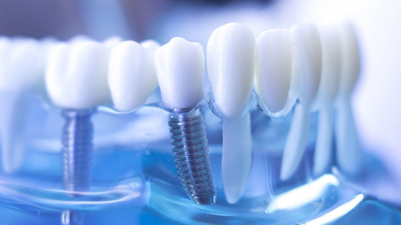 Foto - Bomba teklif Meclis'e geldi! O diş tedavisi ücretsiz oluyor