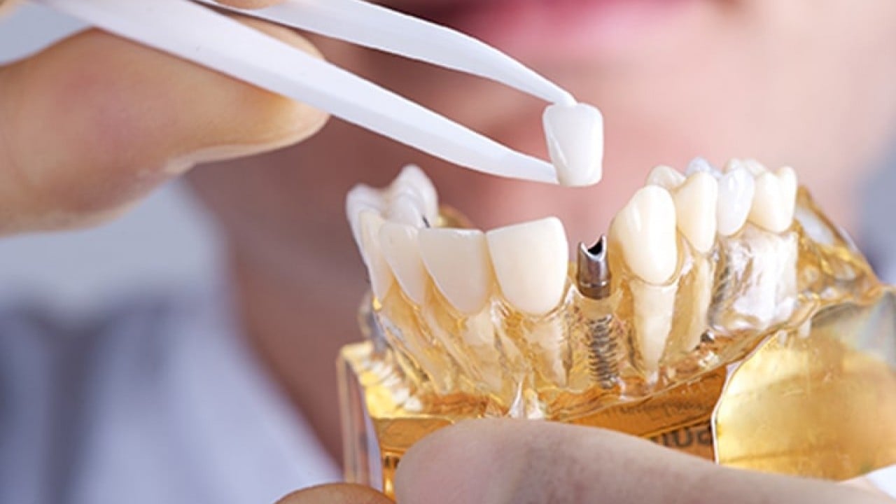 Foto - Bomba teklif Meclis'e geldi! O diş tedavisi ücretsiz oluyor