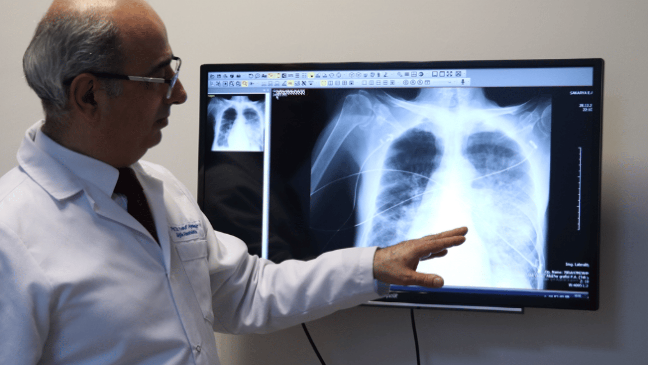 Foto - Bor tabanlı kanser tedavisi! Türk bilim adamları geliştirdi: Yüzde 80 başarılı