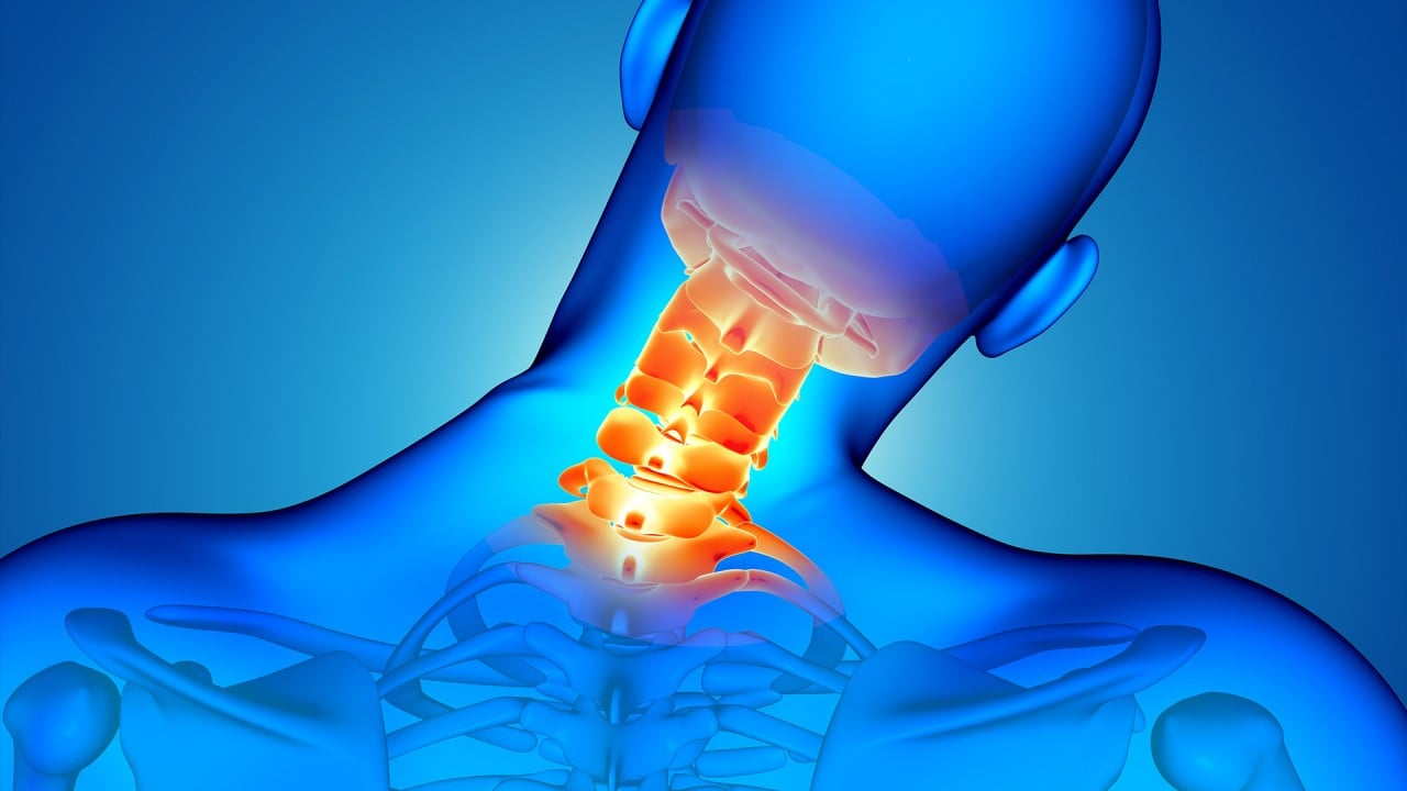 Foto - Boyun fıtığında tedavi gecikmesine dikkat!