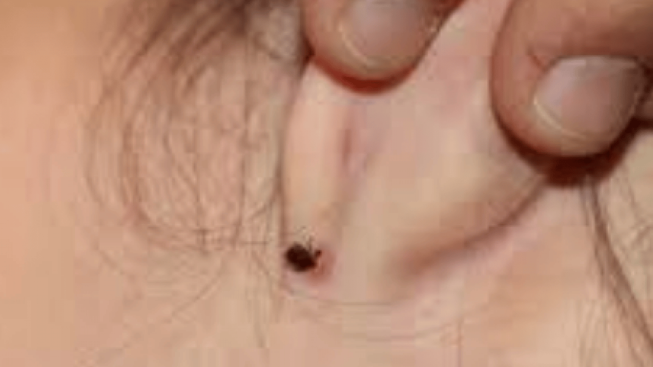 Foto - Bu açıklama O illerimiz için önlem demek! Yoğun yağışla geçen kış mevsimi kene popülasyonunu...