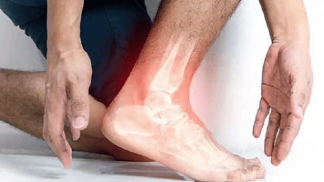 Foto - Bu habere bakın ve not alın: Siz siz olun, ayak bileği burkulmalarını hafife almayın...