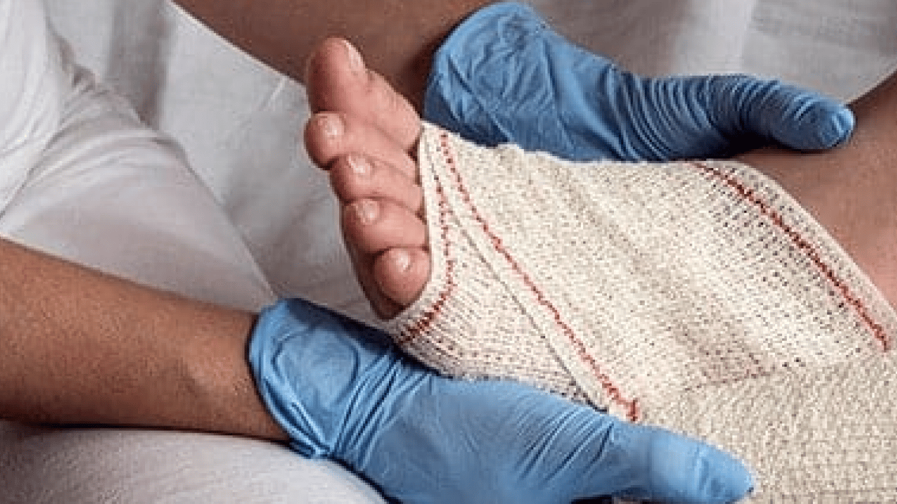 Bu habere bakın ve not alın: Siz siz olun, ayak bileği burkulmalarını hafife almayın...