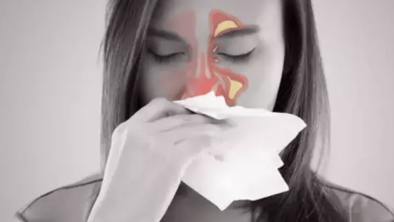 Foto - Bu hamleyi yapmalısınız: Alerjik rinit zamanla şiddetini azaltabilir ancak...