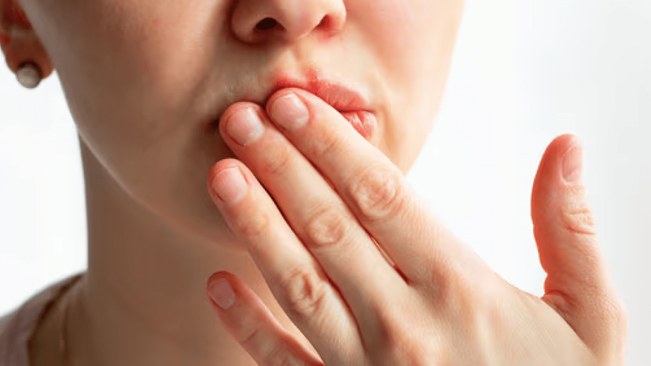 Foto - Bu hamleyi yapmalısınız: Alerjik rinit zamanla şiddetini azaltabilir ancak...