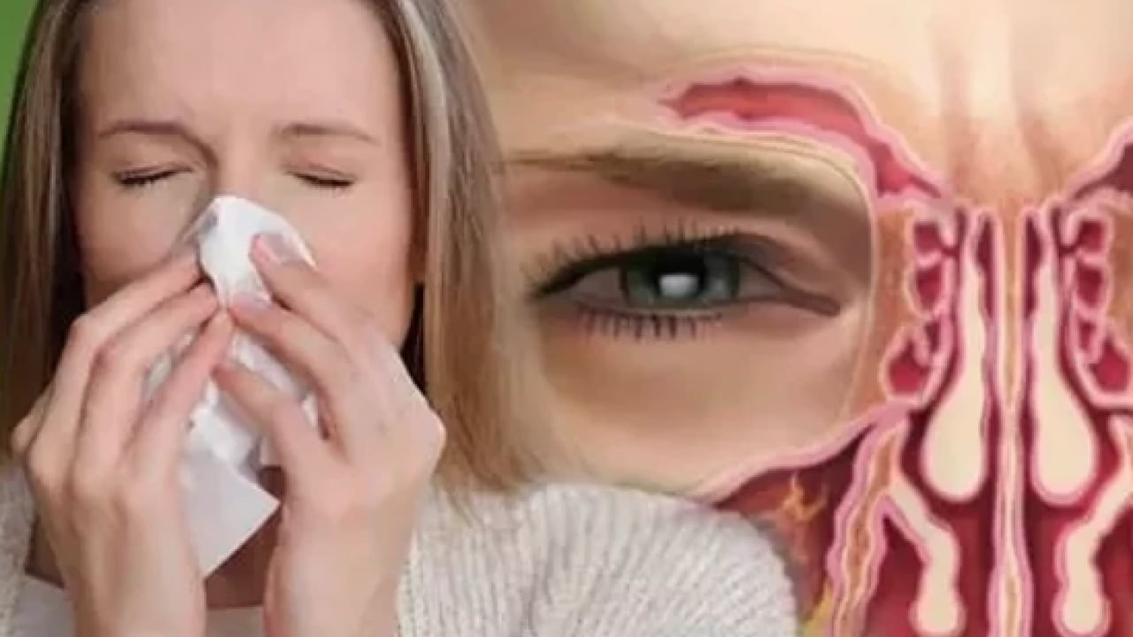 Foto - Bu hastalığa göz yummayın! Burun tıkanıklığını saniyeler içinde açan mucize