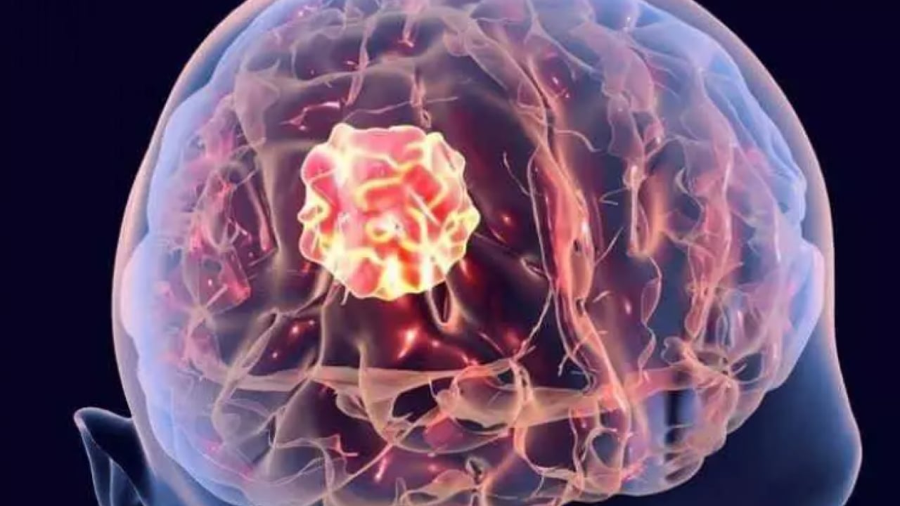 Foto - Bu hastalığı olanlar dikkat: Malulen emekli olmanın şartları belli oldu!