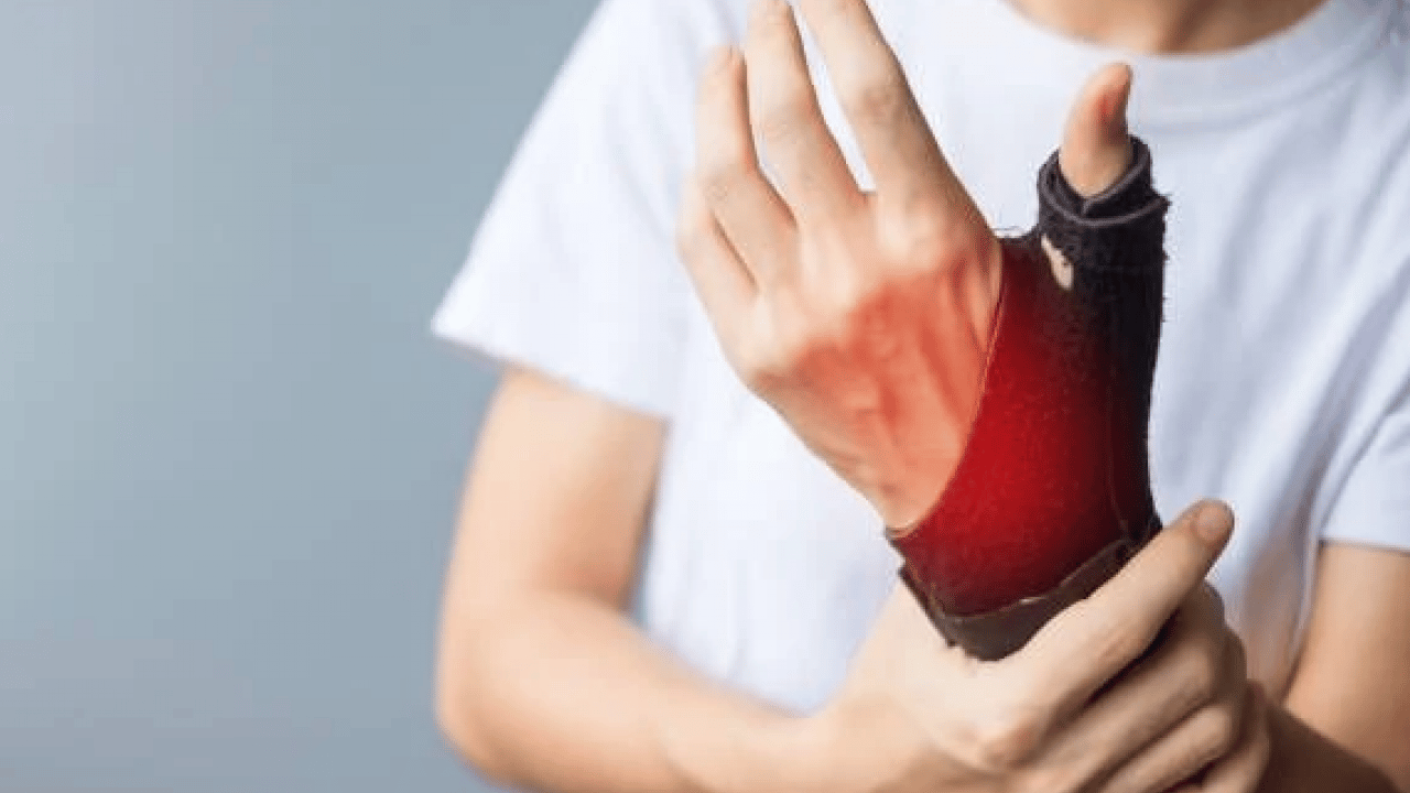 Foto - Bu hastalığın işareti olabilir! El bileğinde uyuşma ve ağrı yaşayanlar dikkat