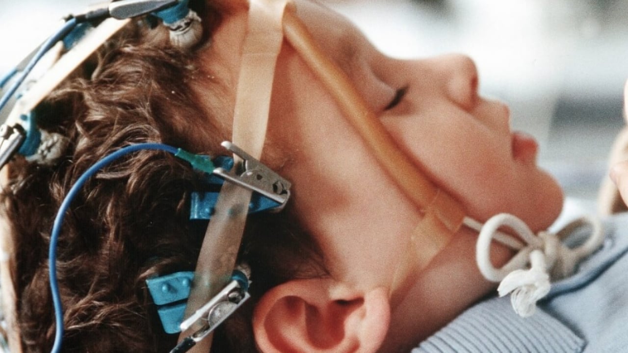 Foto - Bu hastalık detaylara doymuyor bir türlü ama... 'Epilepsi bulaşıcı bir hastalık değildir'