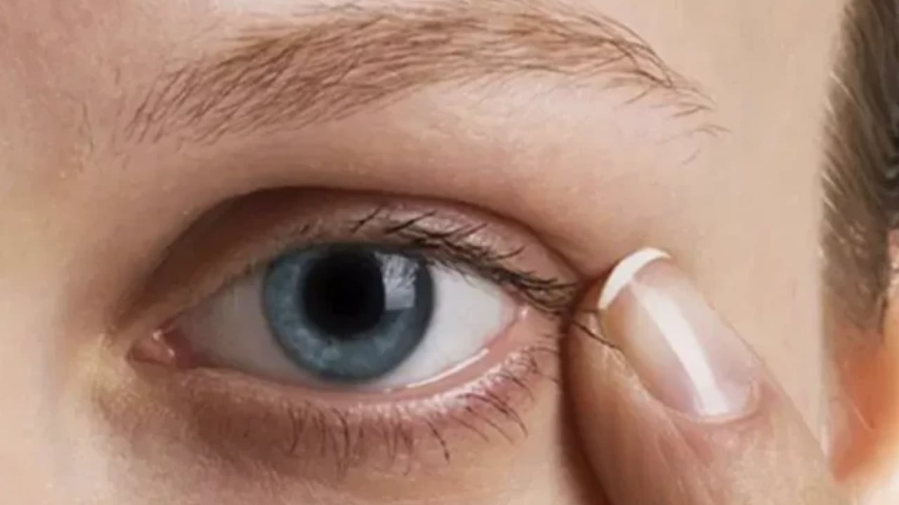 Foto - Herkes yorgunluk deyip geçiyor: Gözlerde kalıcı hasara neden olabilir!