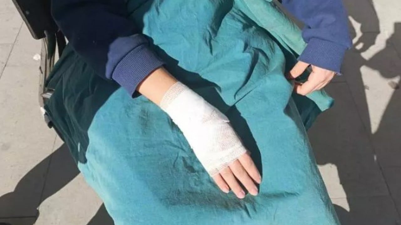 Foto - Bu işe bir çare bulunmalı: Kızın parçalanmadık yeri kalmadı!