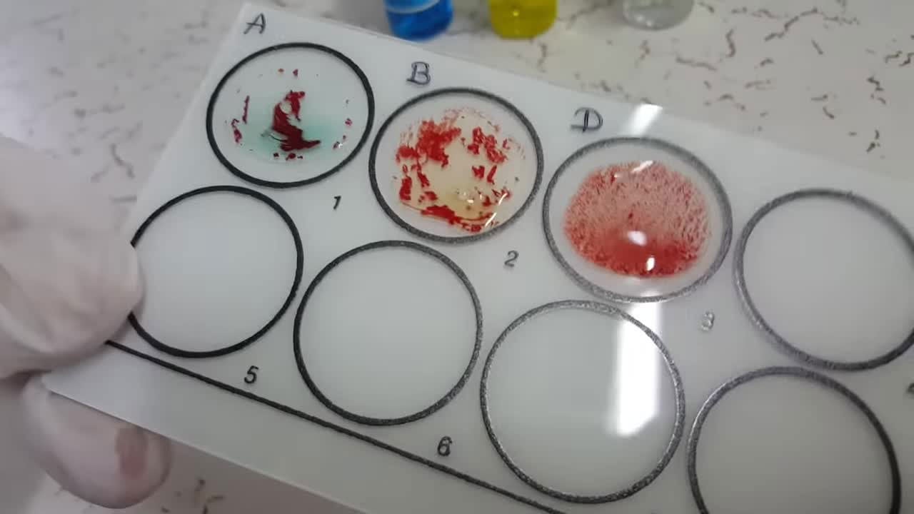 Foto - Bu kan grubuna sahip olanlar dikkat! Diyabet riskinde şaşırtan bağlantı