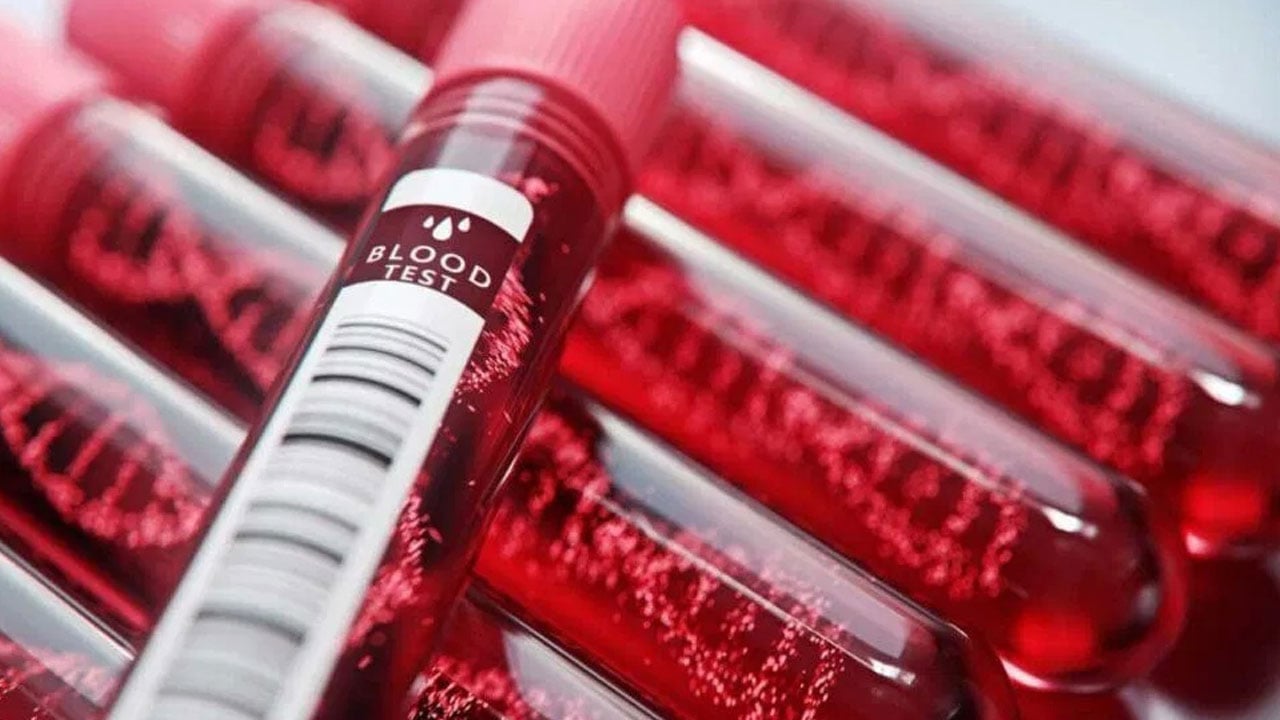 Bu kan grubuna sahip olanlar dikkat! Diyabet riskinde şaşırtan bağlantı