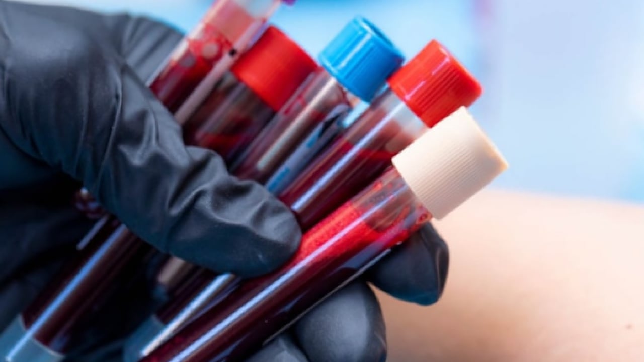 Foto - Bütün gün uyukluyorlar: En yorgun kan grubu belli oldu!