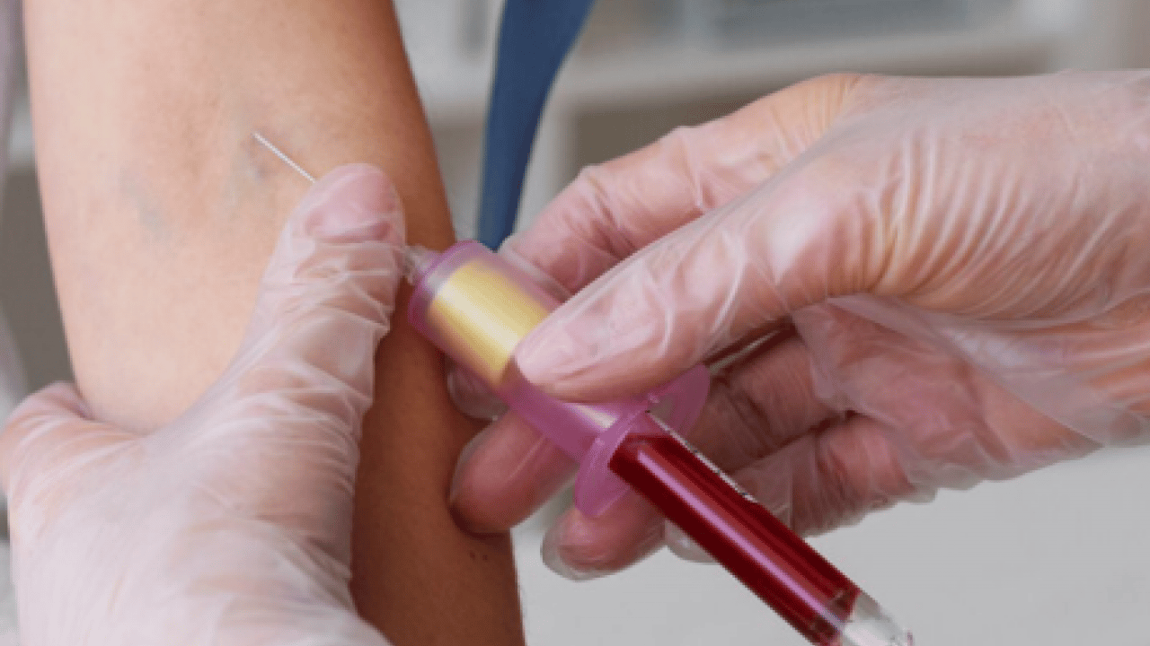 Foto - Diyabete en yatkın kan grubu belli oldu! Bilim insanları açıkladı!