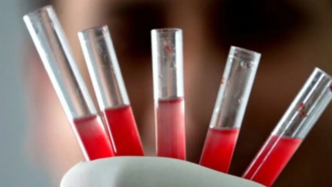 Foto - Diyabete en yatkın kan grubu belli oldu! Bilim insanları açıkladı!